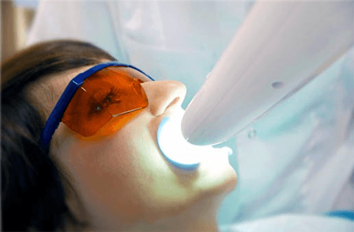 Understanding the Causes of Teeth Sensitivity Waterlooville