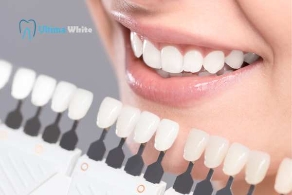 How to Maximise the Results of Your Laser Teeth Whitening Treatment Waterlooville