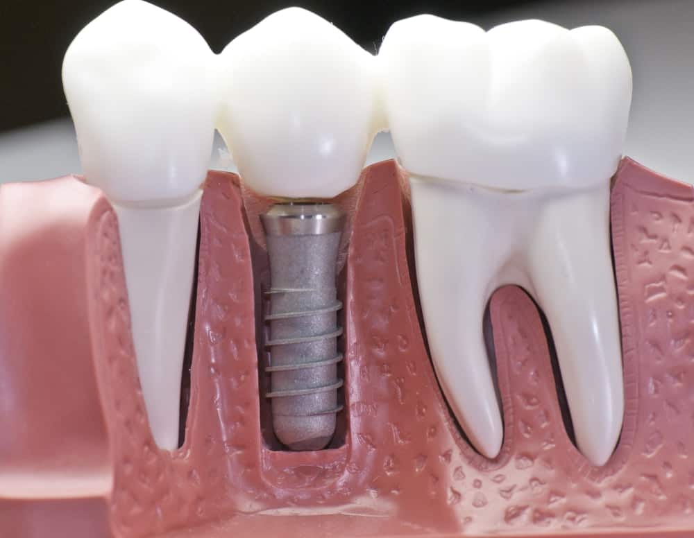 Common Misconceptions About Modern Dental Treatments Waterlooville
