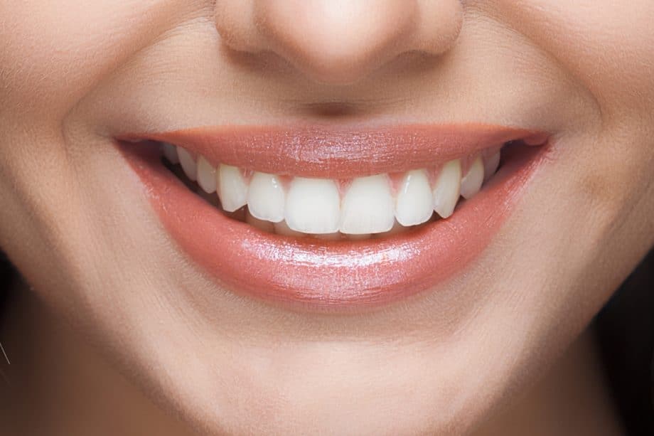 The Role of a Balanced Diet in Long-Term Whitening Results Waterlooville