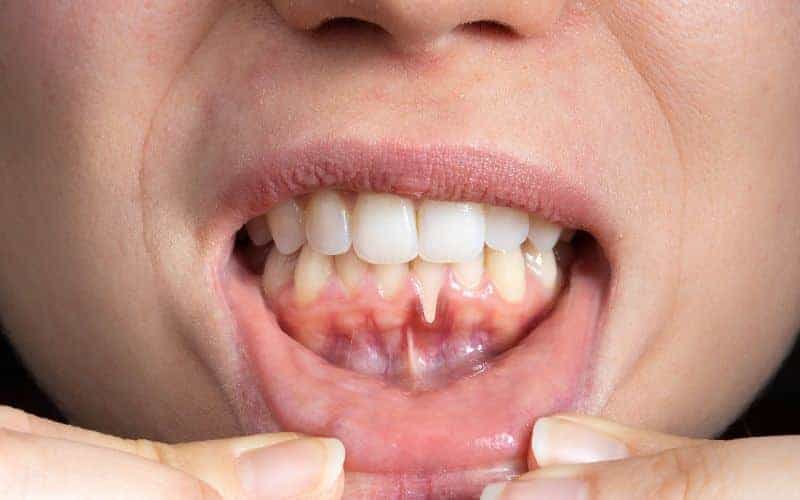 Final Thoughts: Building Lifelong Enamel Protection Habits Waterlooville