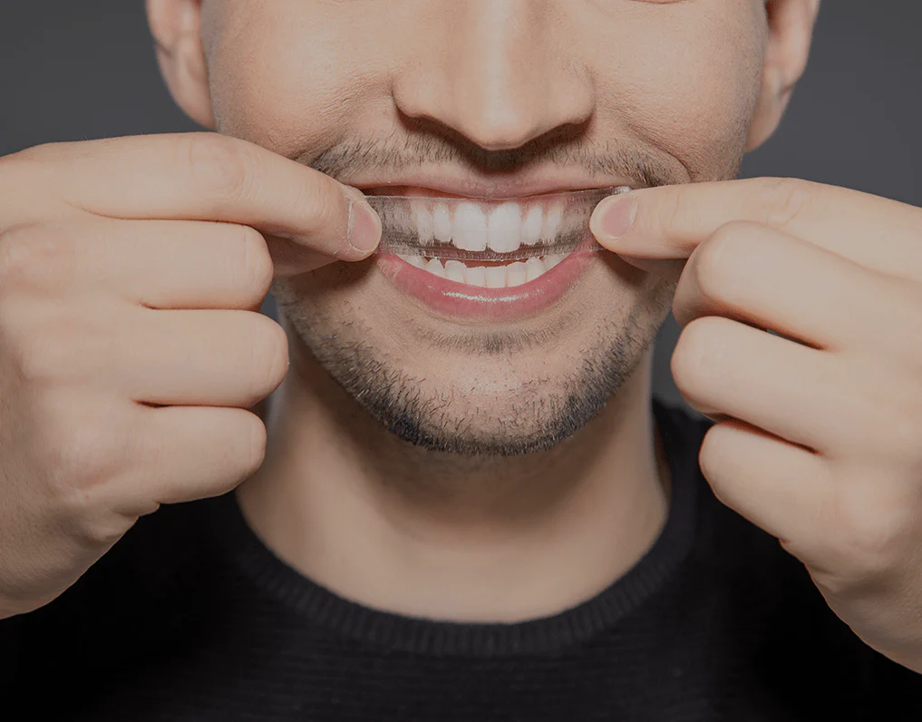 Can You Whiten Natural Teeth Without Harsh Chemicals Waterlooville?