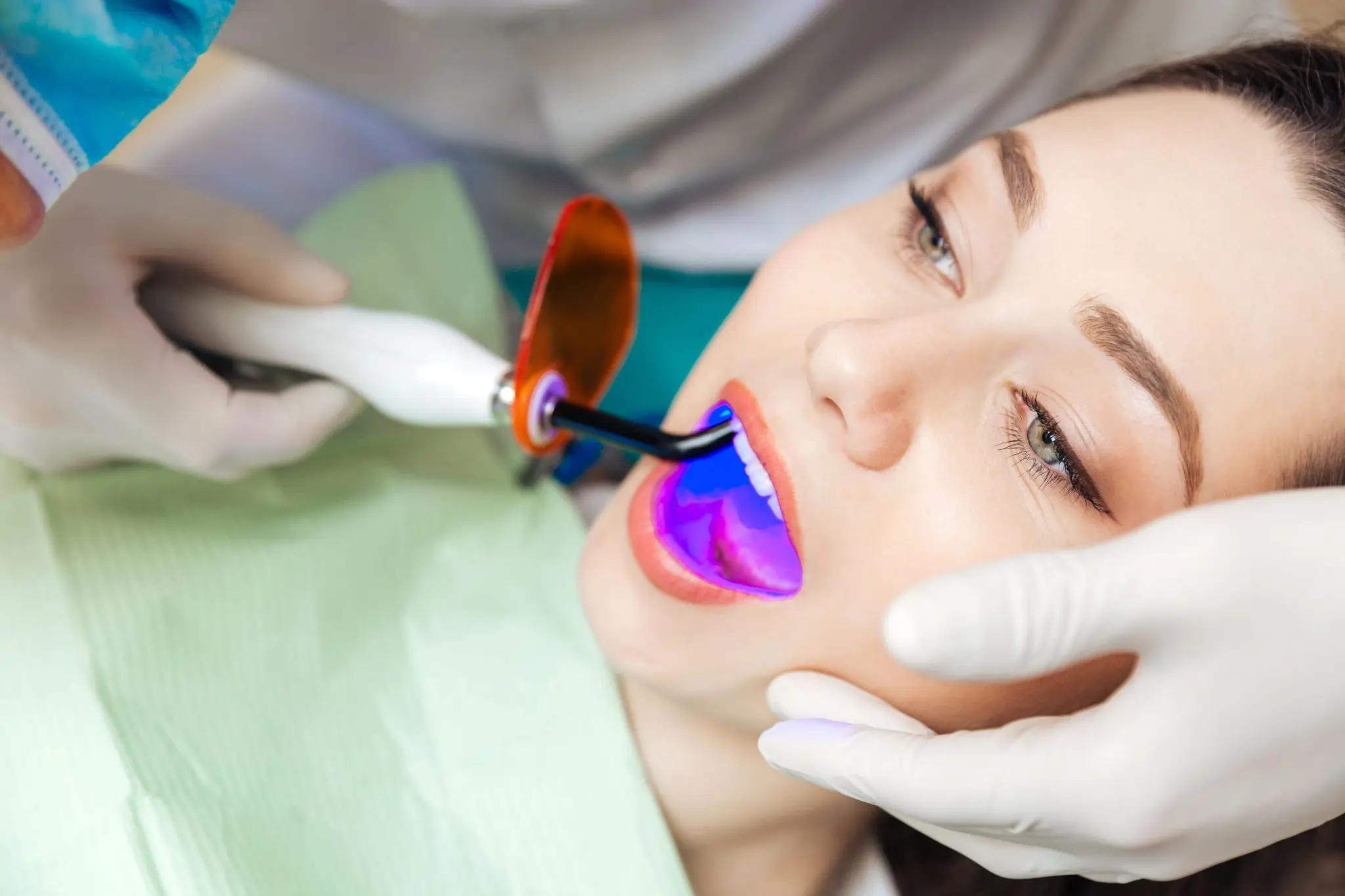 Is Laser Teeth Whitening Safe and Effective Waterlooville?