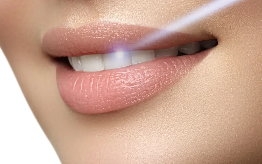What Are Simple Ways to Improve the Look of Your Smile Waterlooville?