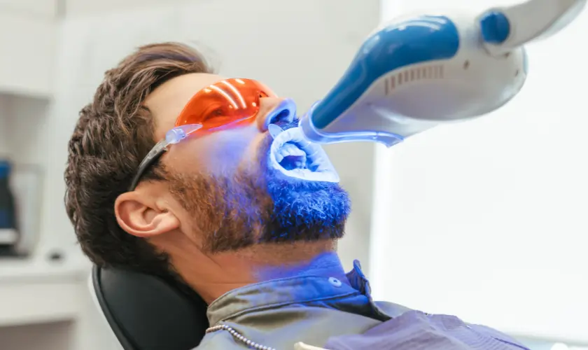 How Does Laser Teeth Whitening Actually Work Waterlooville?
