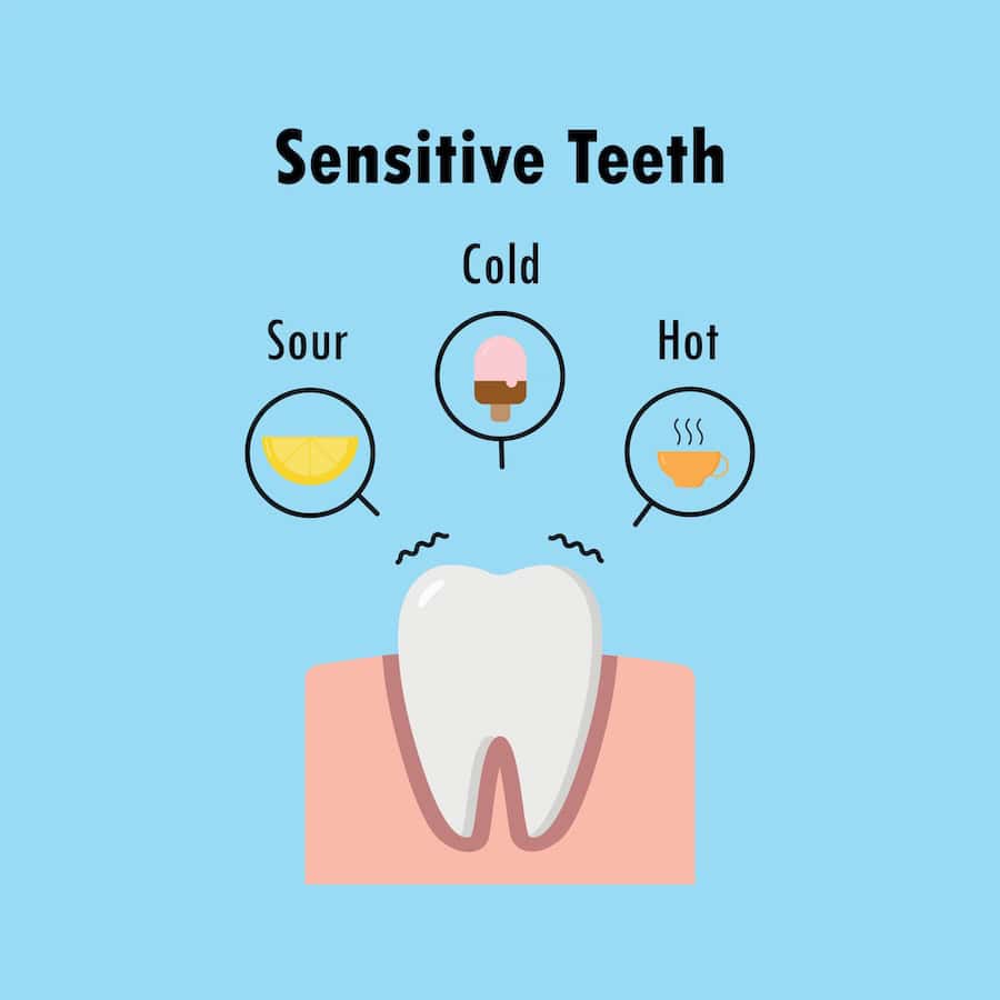 Why Do Teeth Become Sensitive After Whitening Treatments Waterlooville?