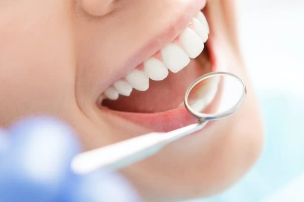 Preventing White Spots on Teeth Waterlooville