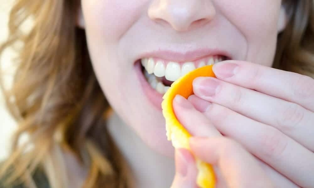 Are DIY Teeth Whitening Remedies Safe for Your Teeth and Enamel Waterlooville?