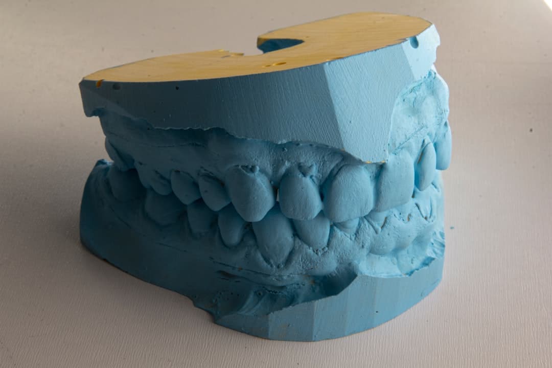 How Do Dental Implants Improve Jawbone Health and Oral Function Waterlooville?