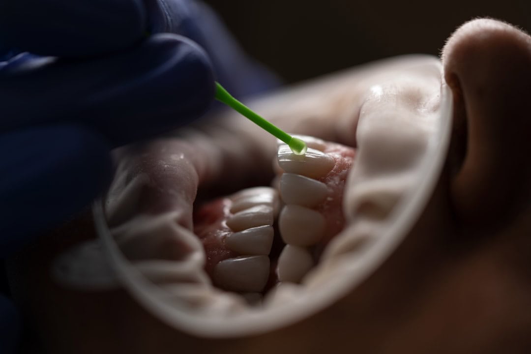 The Role of Saliva: Nature’s Defense System Waterlooville