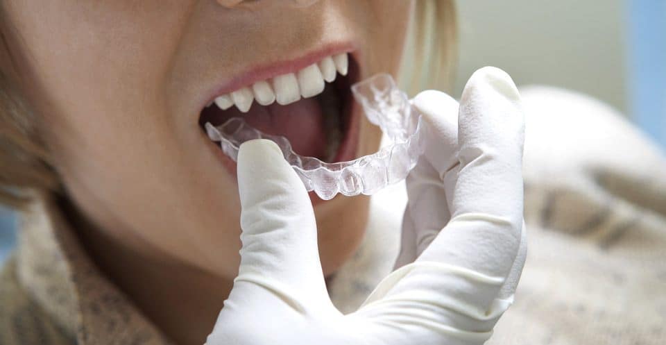 Can Bruxism Affect Your Sleep Quality Waterlooville