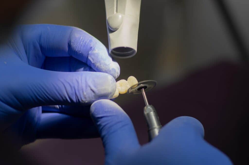 Customised Dental Solutions: Crowns, Aligners, and Implants Waterlooville